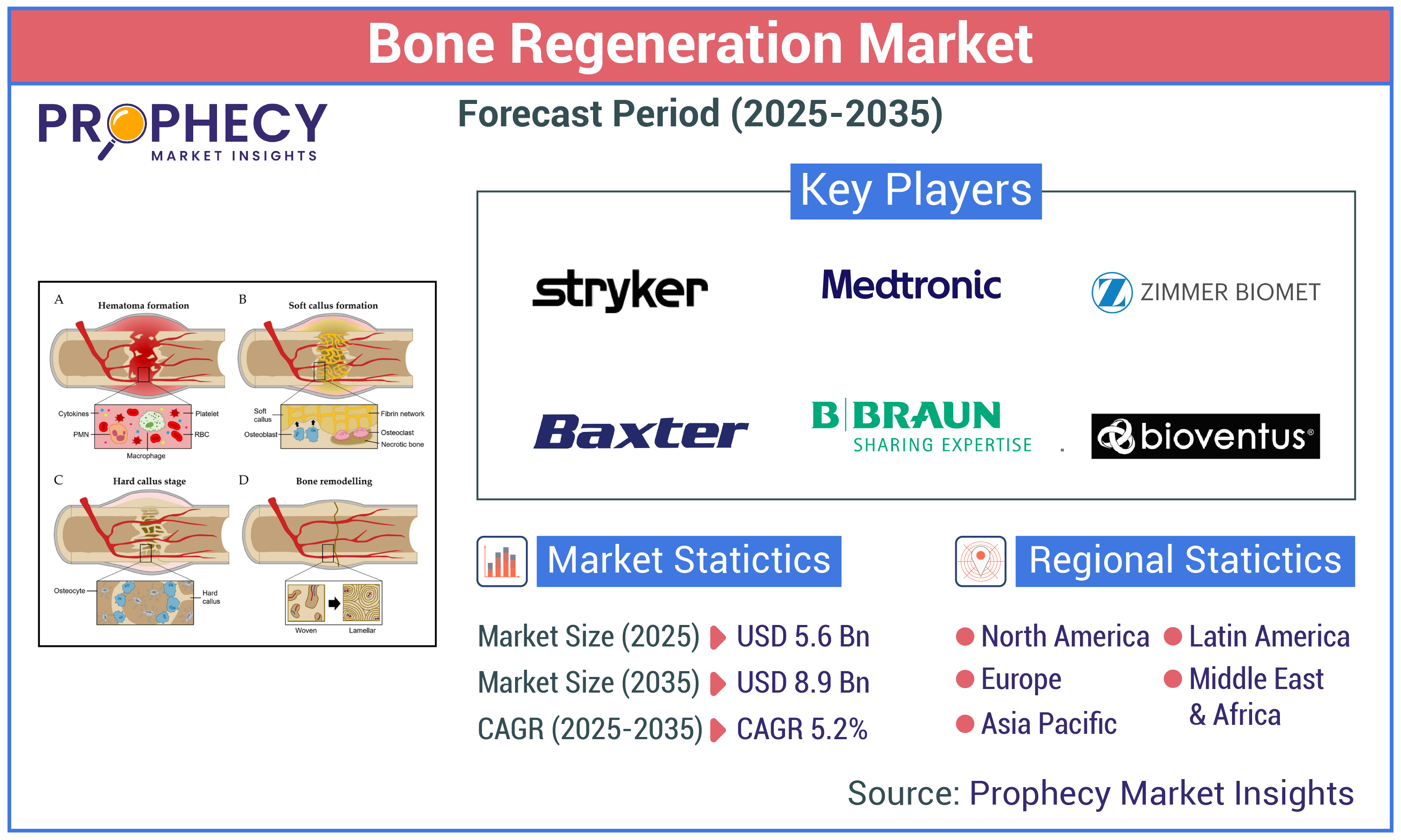 Bone Regeneration Market