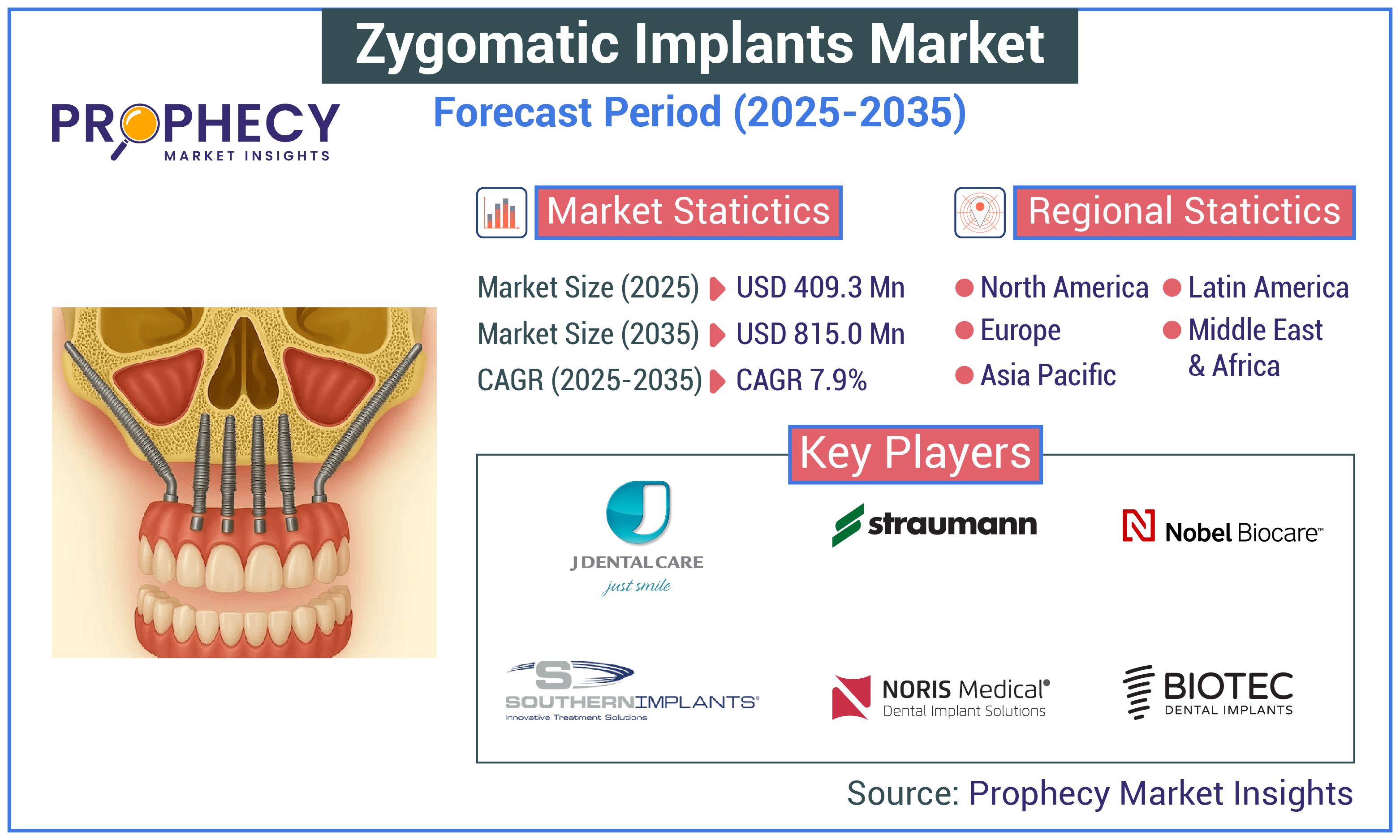 Zygomatic Implants Market Zygomatic Implants Market