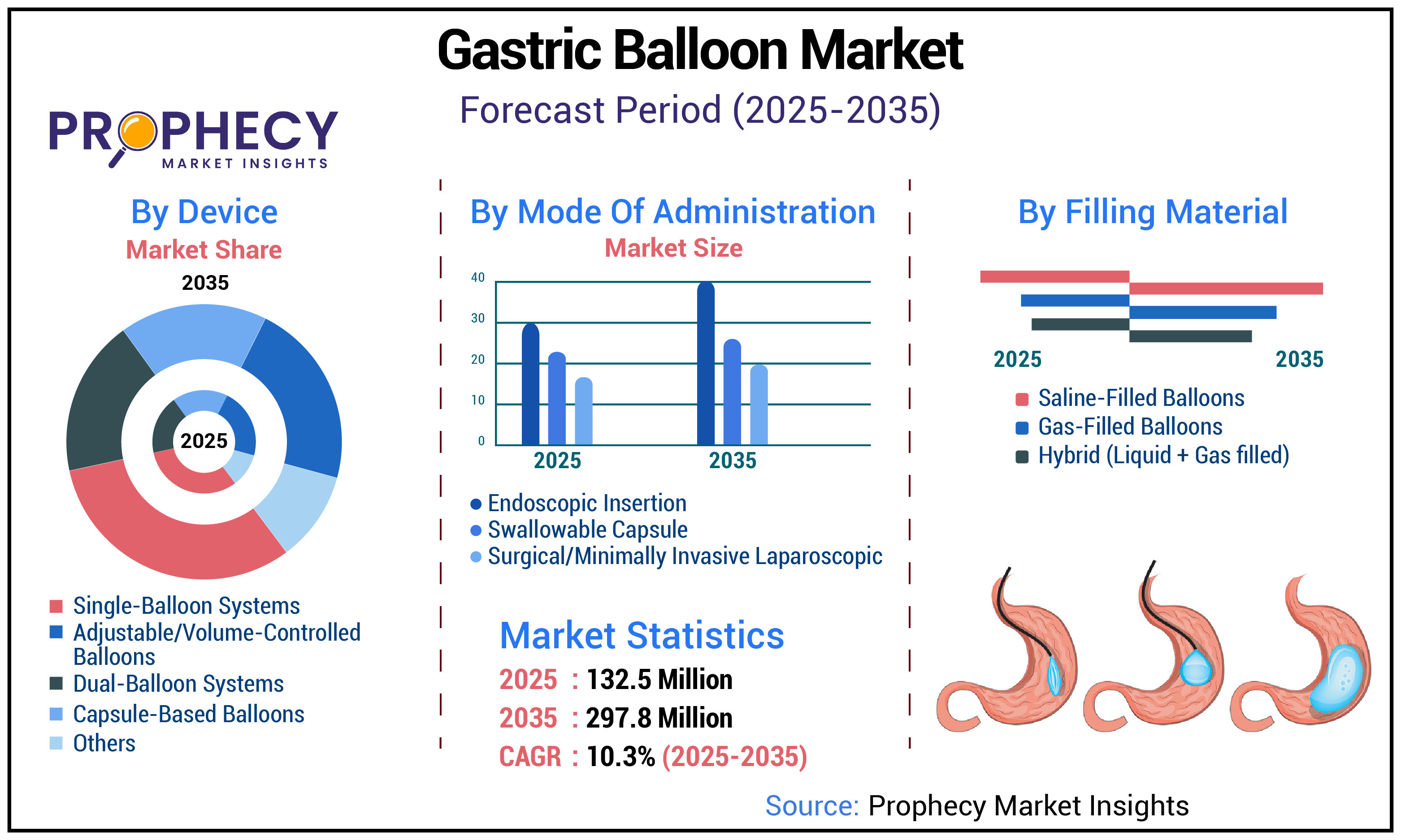 Gastric Balloon Market Gastric Balloon Market