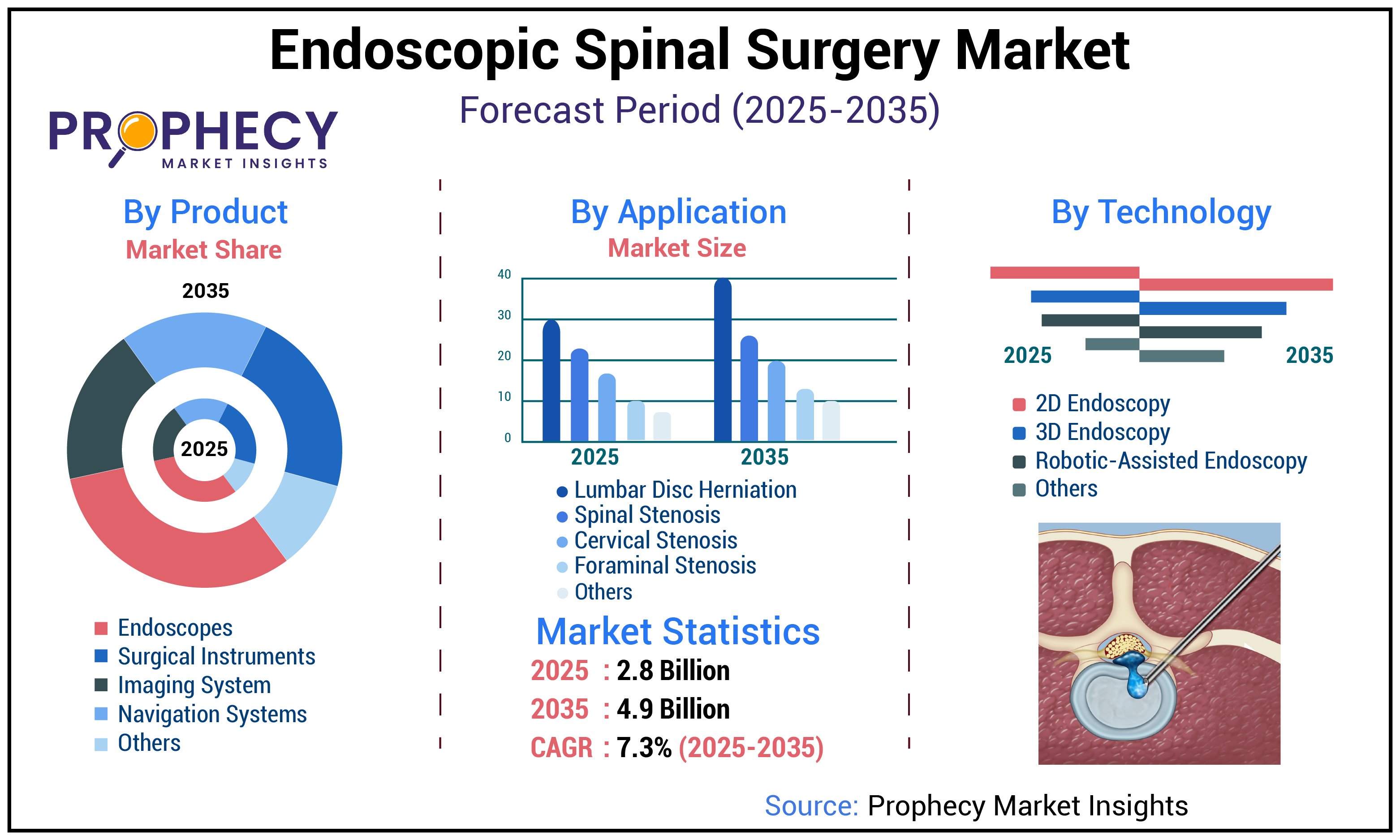 Endoscopic Spinal Surgery Market Endoscopic Spinal Surgery Market