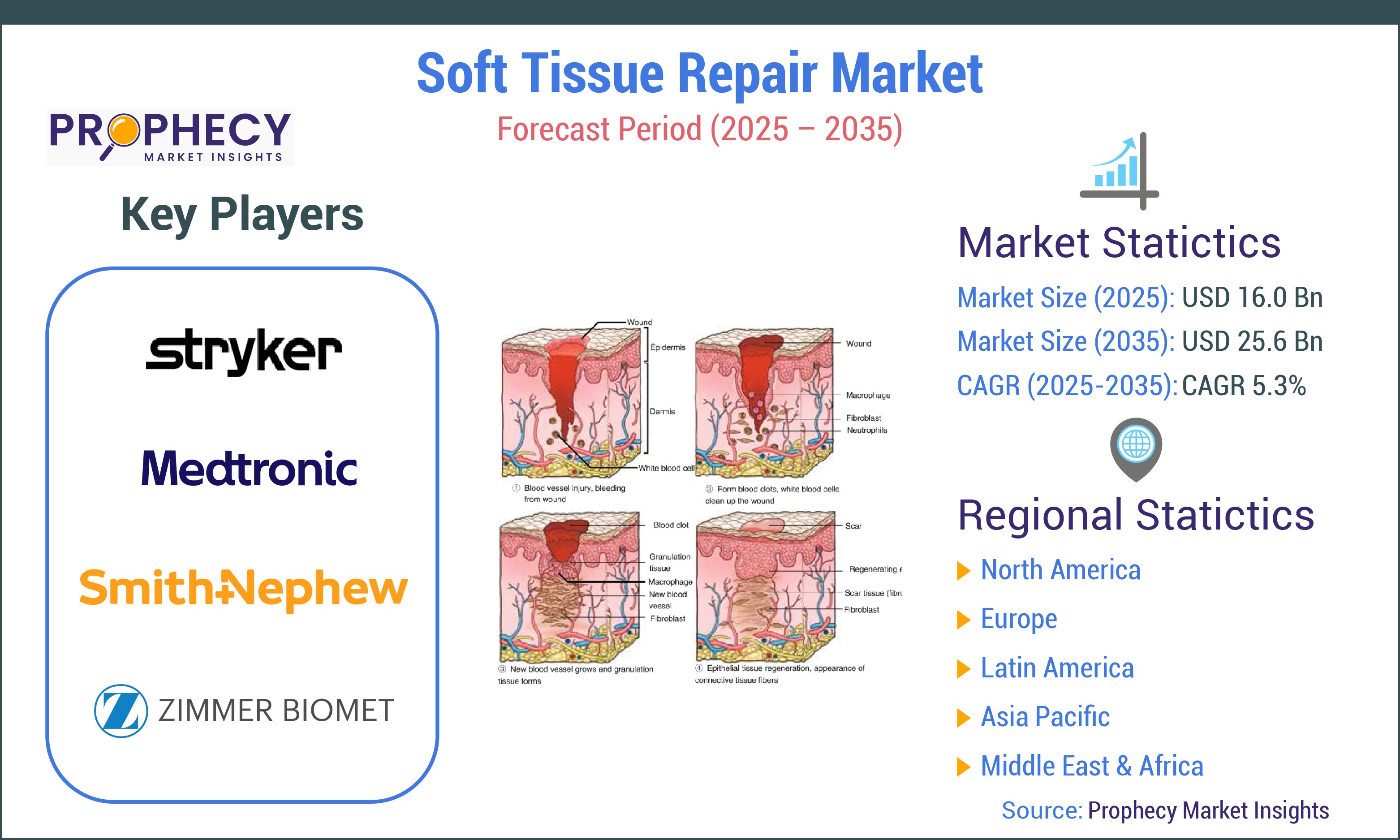 Soft Tissue Repair Market Soft Tissue Repair Market